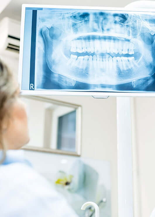 patient being shown their dental x-ray