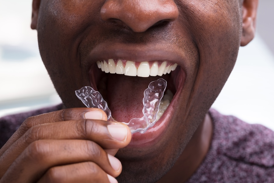 Invisalign, oral health, gum disease, teeth alignment, holistic dentistry, Dallas