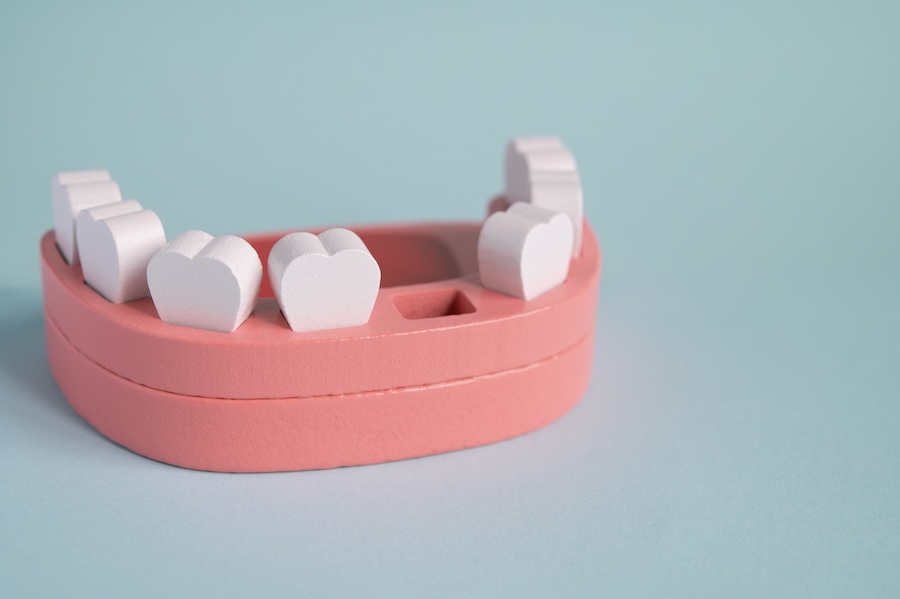 missing teeth, how to eat with a missing tooth